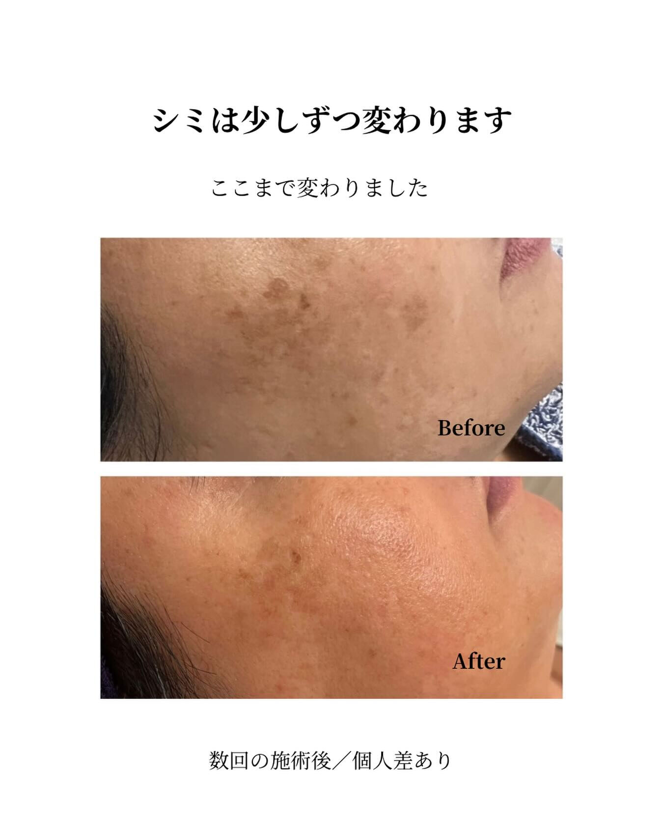 【症例】