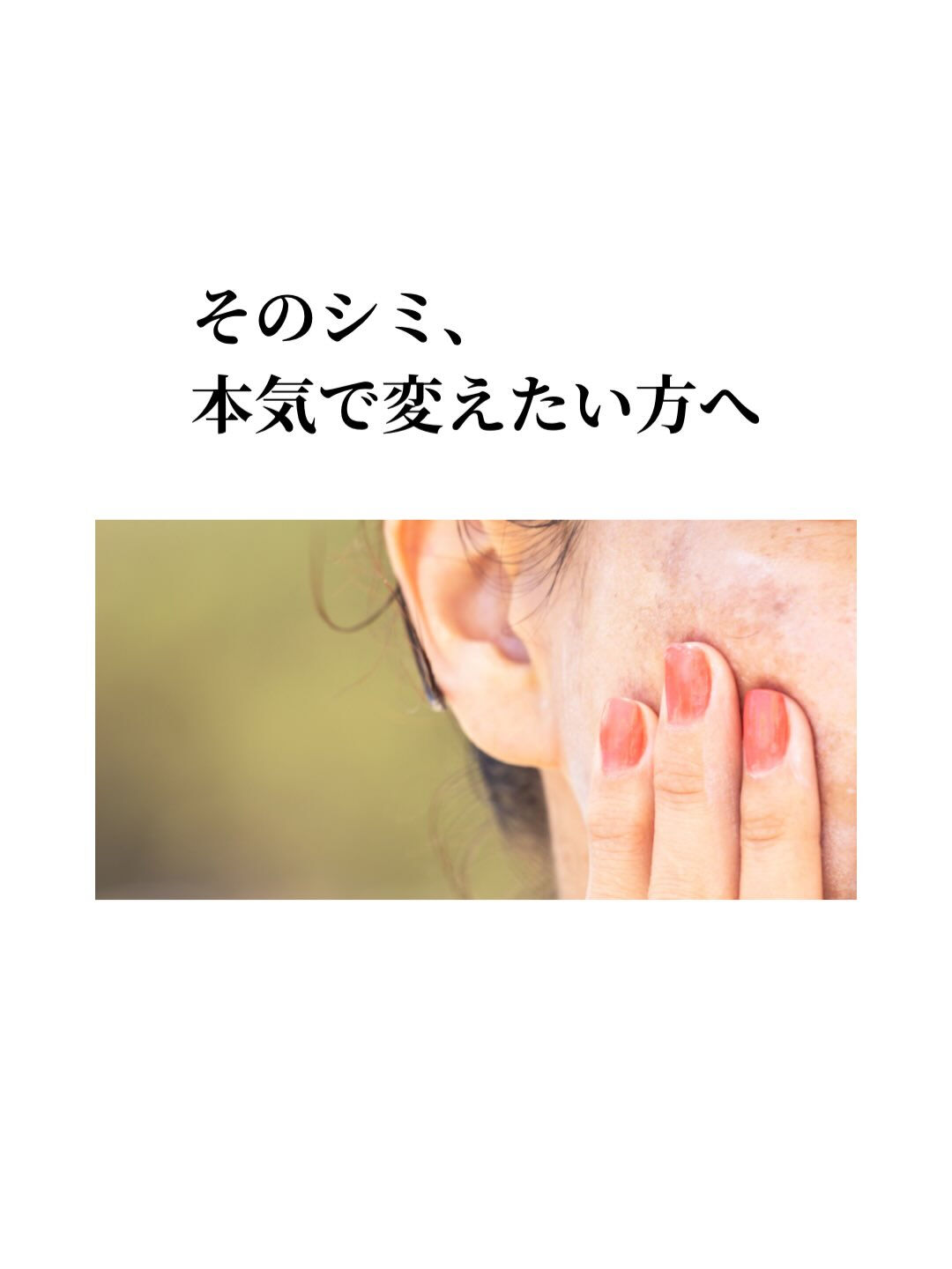 そのシミ、