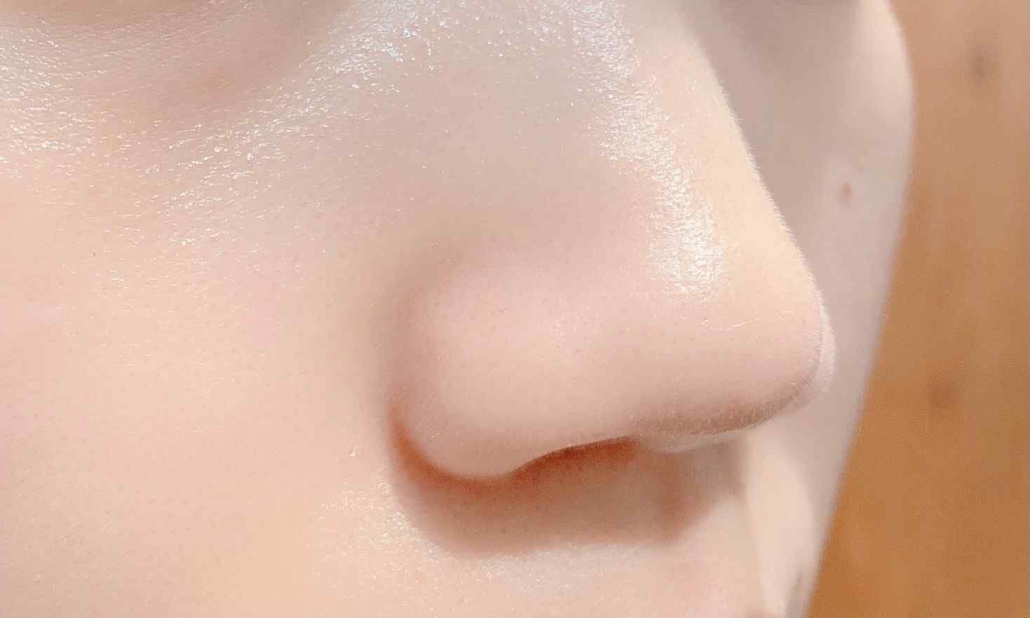 毛穴